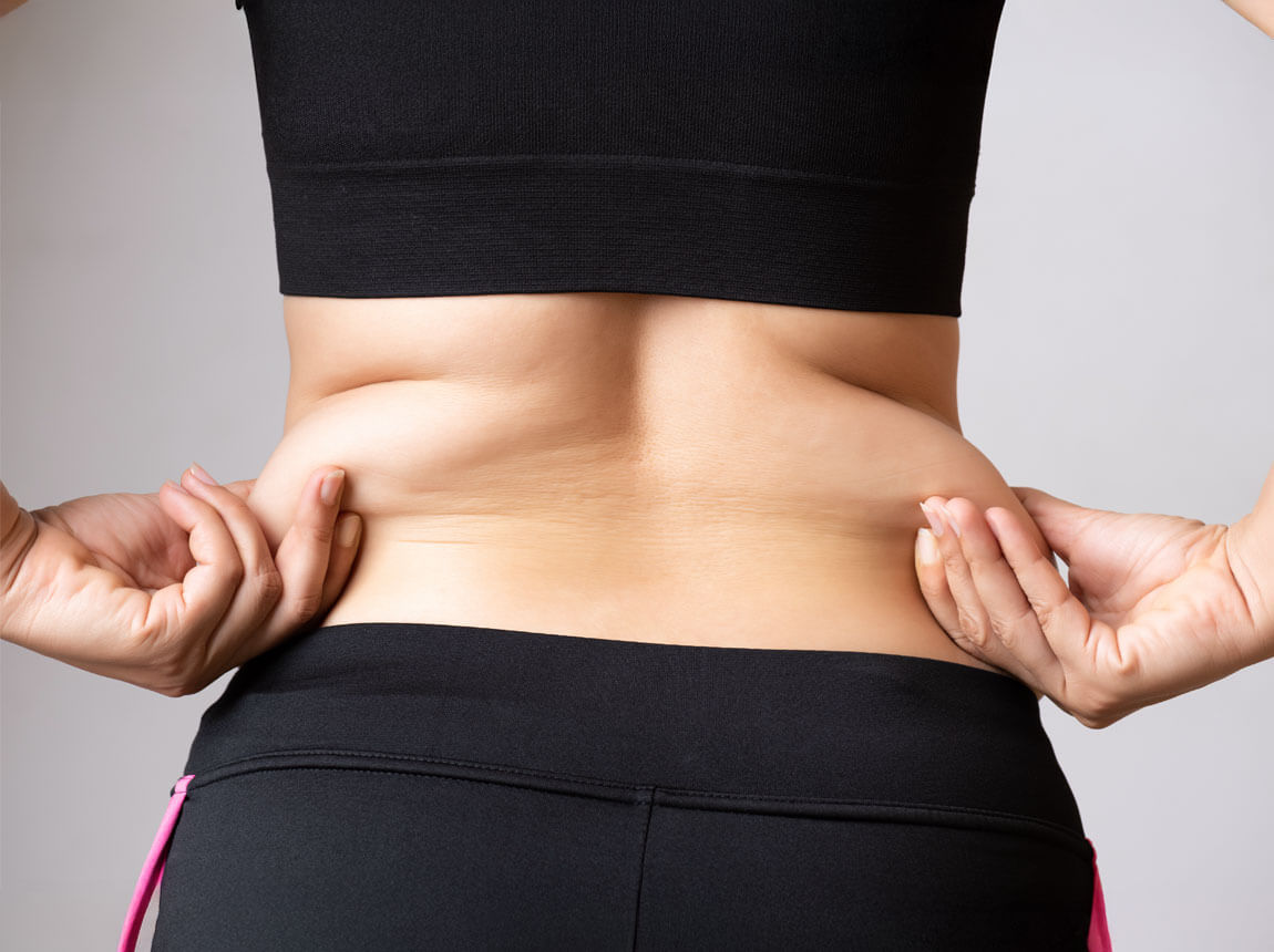 žena - hubnutí, boky