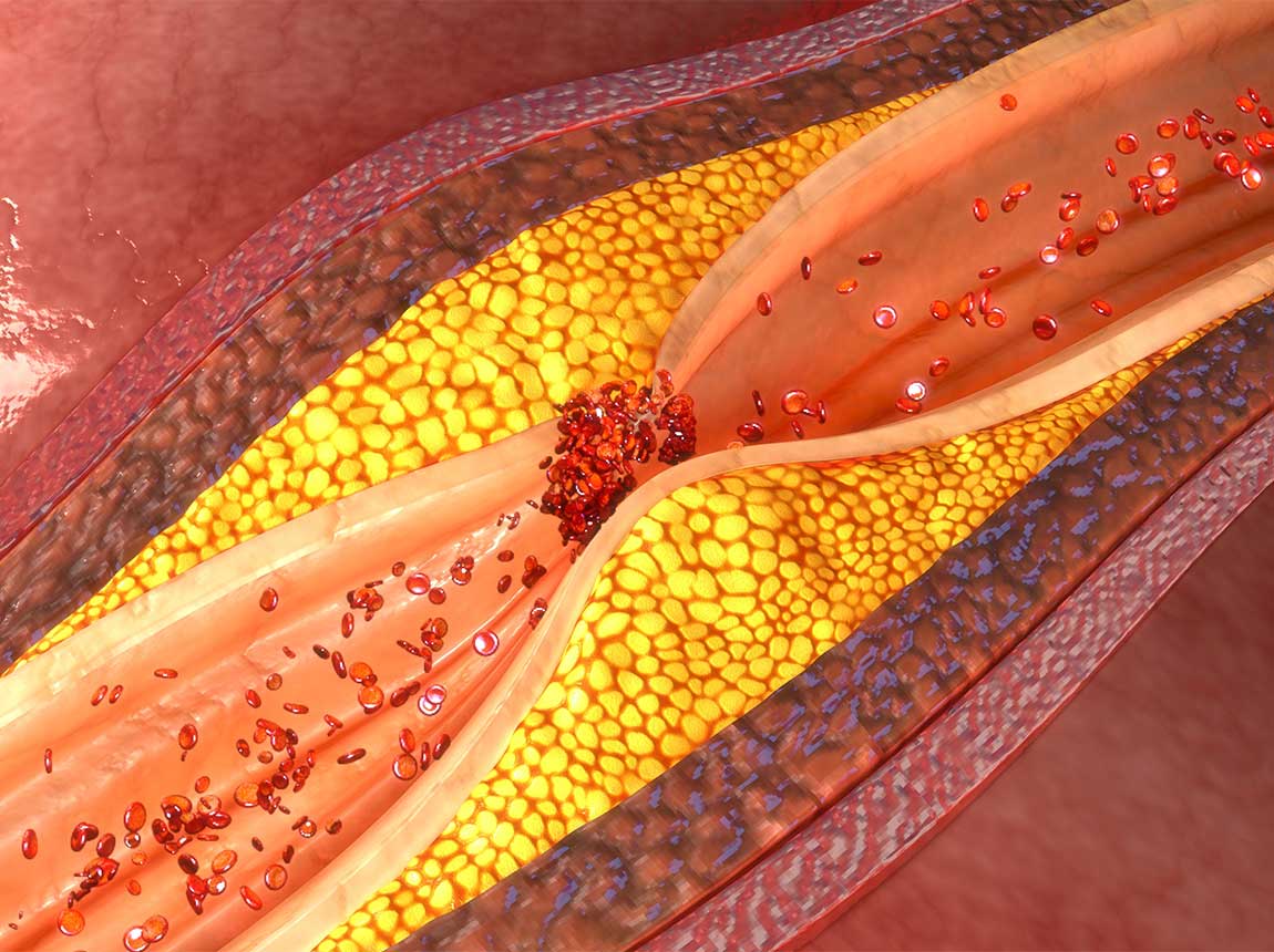 ucpan&eacute; ž&iacute;ly &ndash; cholesterol
