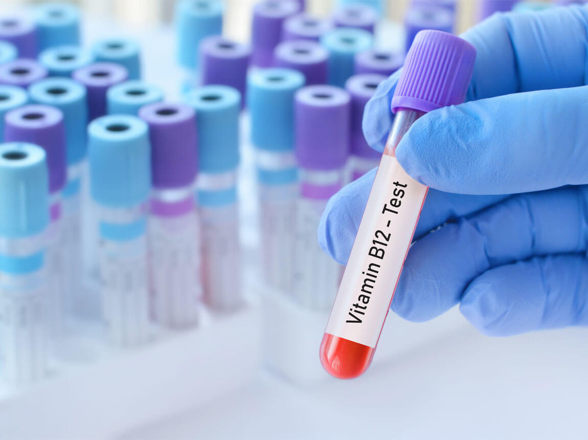 vitamin B12